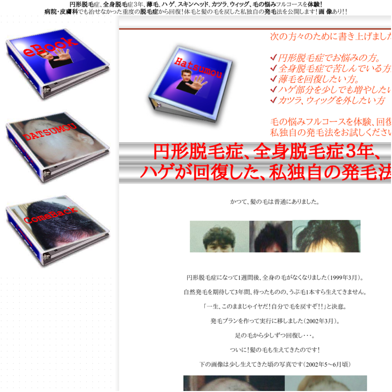 ハゲ頭★巨大画像公開★円形脱毛症、全身脱毛症3年、ハゲが回復した私独自の発毛法