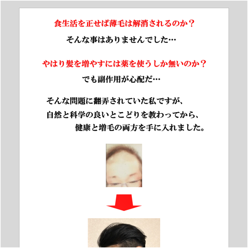 育毛サーファー －髪の自由を手にする市民革命－